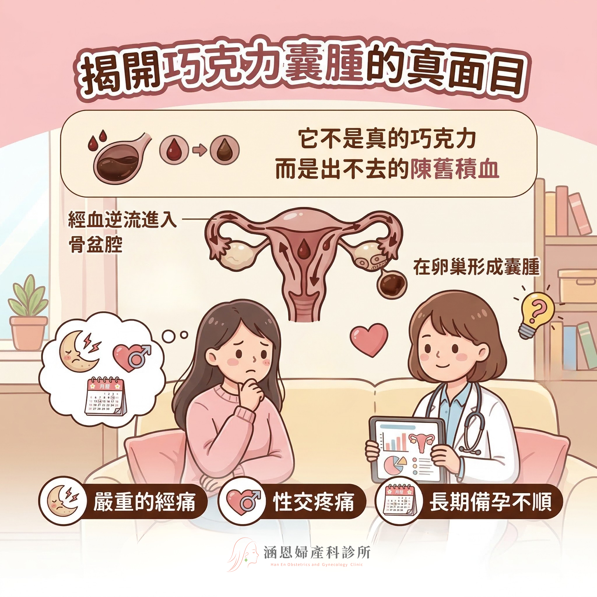 巧克力囊腫的形成過程：子宮內膜樣組織長在卵巢，隨週期反覆出血與發炎，血液累積形成深褐色囊腫